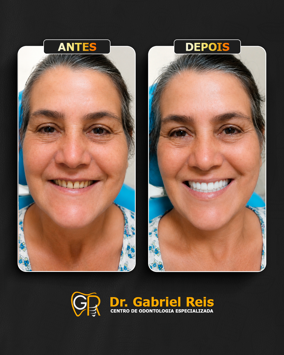 Antes e depois 1