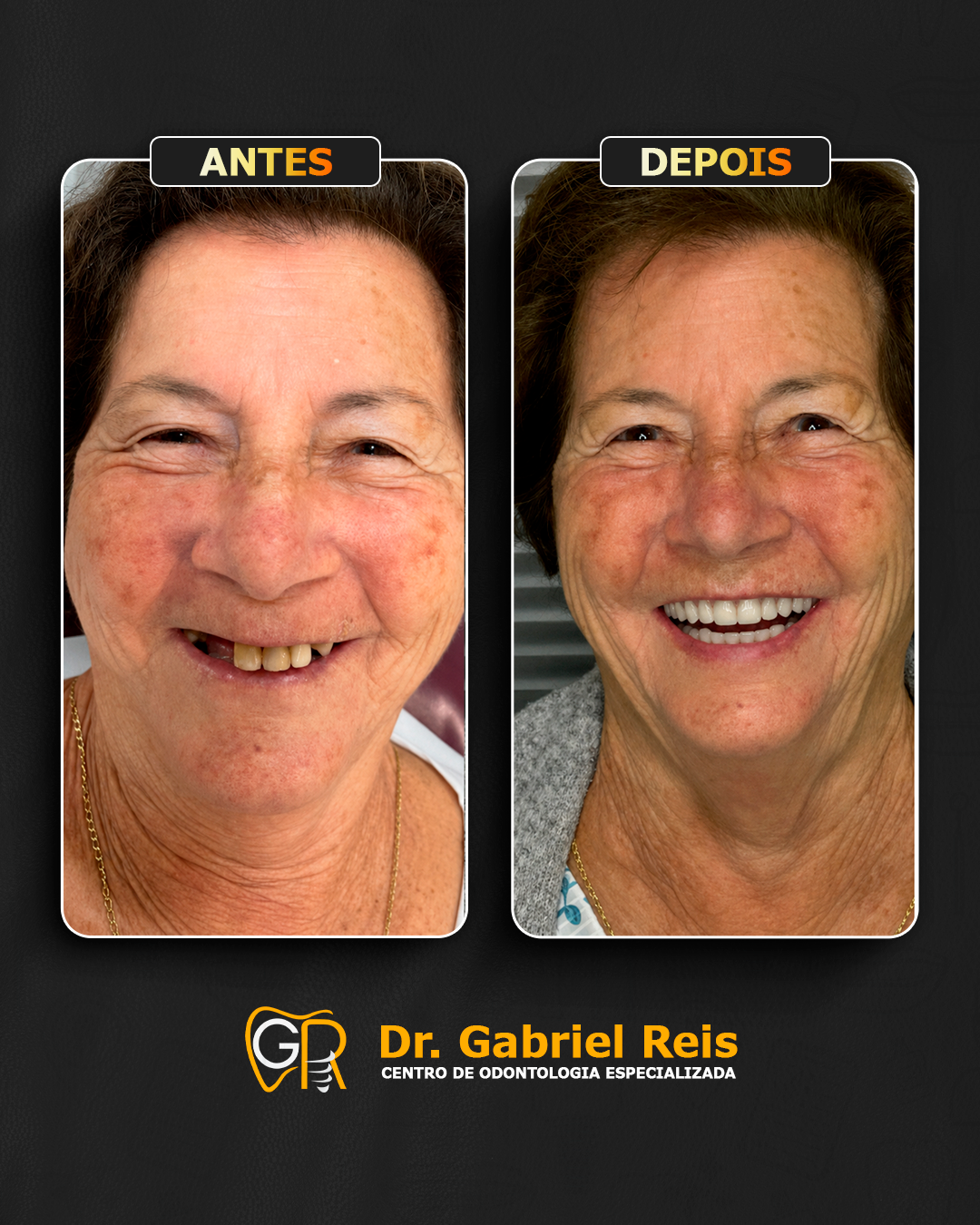 Antes e depois 2
