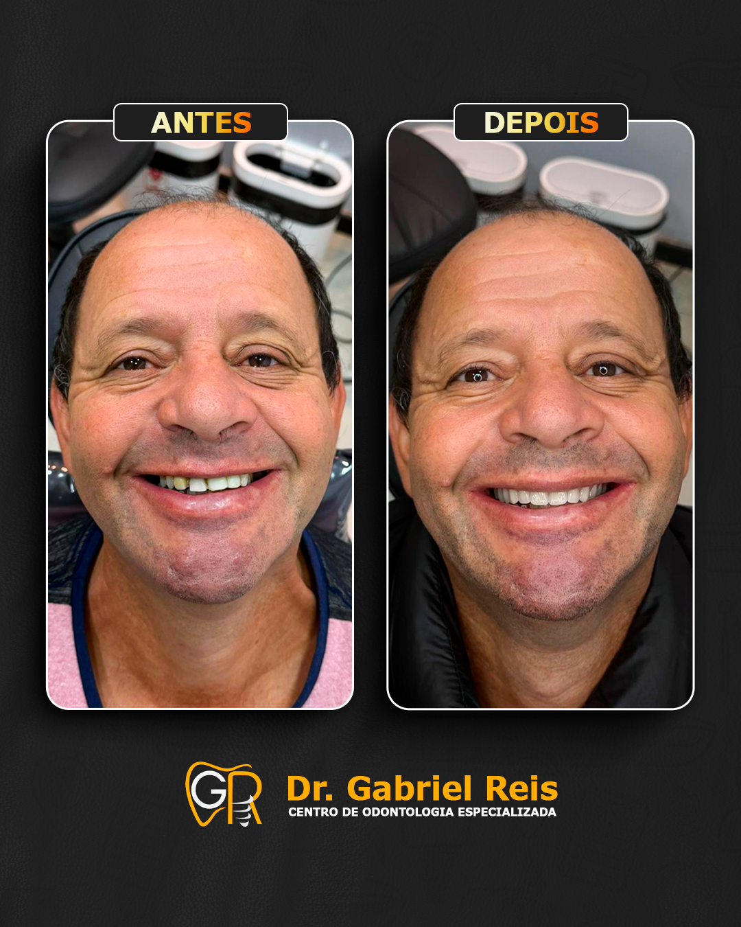 Antes e depois 3