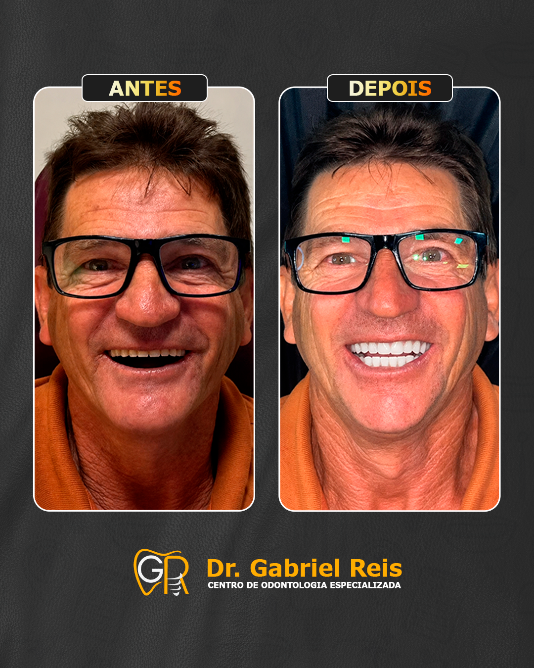 Antes e depois 4